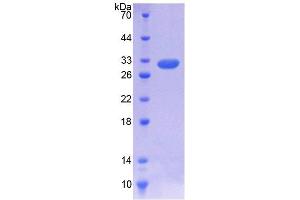 SDS-PAGE analysis of Rat IL7R Protein. (IL7R Protein)