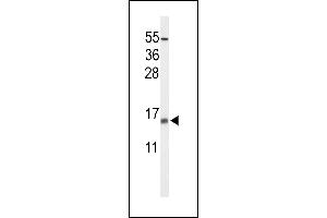 Western blot analysis of KCE1L Antibody (Center) (ABIN653619 and ABIN2842976) in NCI- cell line lysates (35 μg/lane). (KCNE1-Like antibody  (AA 67-96))