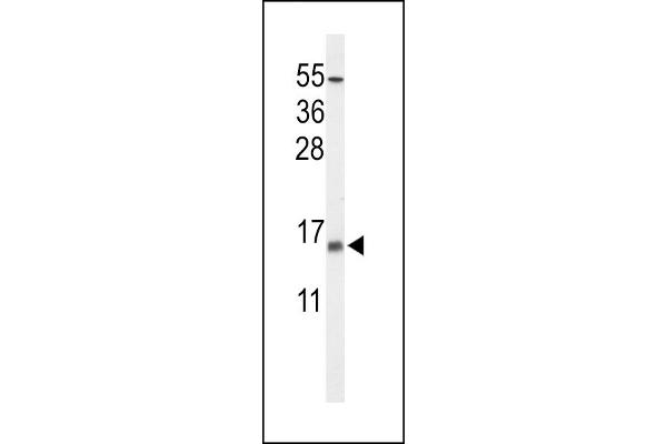 KCNE1-Like antibody  (AA 67-96)