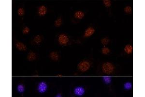 Immunofluorescence analysis of L-929 cells using GLI2 Polyclonal Antibody at dilution of 1:100. (GLI2 antibody)