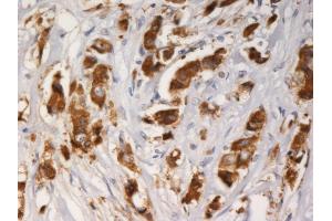 Immunohistochemistry staining of AGR3 with mouse monoclonal AGR3. (AGR3 antibody)