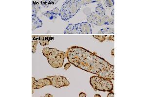Immunohistochemistry (IHC) image for anti-Insulin Receptor (INSR) (C-Term) antibody (ABIN6254165) (Insulin Receptor antibody  (C-Term))