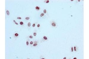 Immunocytochemistry (ICC) image for anti-Histone Cluster 1, H3a (HIST1H3A) (acLys56) antibody (ABIN7127267)
