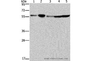 Western blot analysis of Hela, 293T, A549, HT-29 and K562 cell, using NUP50 Polyclonal Antibody at dilution of 1:200 (NUP50 antibody)