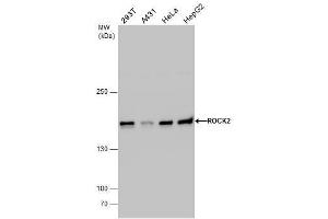 Western Blotting (WB) image for anti-rho-Associated, Coiled-Coil Containing Protein Kinase 2 (ROCK2) antibody (ABIN2855440)