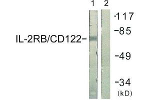 Western Blotting (WB) image for anti-Interleukin 2 Receptor, beta (IL2RB) (Tyr364) antibody (ABIN1848052) (IL2 Receptor beta antibody  (Tyr364))
