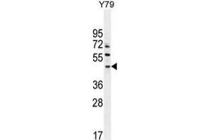 Western blot analysis in Y79 cell line lysates (35ug/lane) using LACE1 Antibody (N-term). (LACE1 antibody  (N-Term))