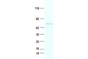 Western Blotting (WB) image for Adenylate Kinase 8 (AK8) protein (His tag) (ABIN2712989)