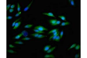 Immunofluorescent analysis of Hela cells using ABIN7156468 at dilution of 1:100 and Alexa Fluor 488-congugated AffiniPure Goat Anti-Rabbit IgG(H+L) (CD51 antibody  (AA 775-885))