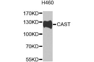Western blot analysis of extracts of H460 cells, using CAST antibody (ABIN2650901) at 1:1000 dilution. (Calpastatin antibody)