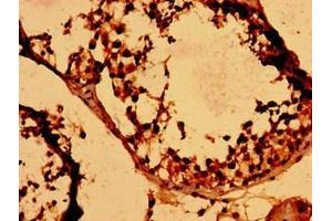 Immunohistochemistry of paraffin-embedded human testis tissue using ABIN7155403 at dilution of 1:100