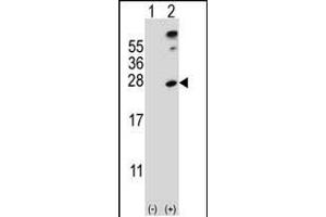 Western blot analysis of SENP8 (arrow) using rabbit polyclonal SENP8 Antibody (S19) (ABIN388073 and ABIN2845796).