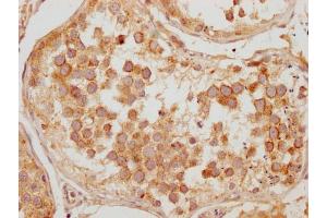 IHC image of ABIN7157259 diluted at 1:200 and staining in paraffin-embedded human testis tissue performed on a Leica BondTM system. (KBTBD7 antibody  (AA 475-684))