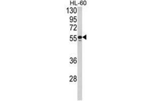 Western blot analysis of NR1H2 Antibody (N-term) in HL-60 cell line lysates (35ug/lane). (NR1H2 antibody  (N-Term))