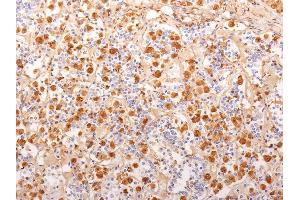 Formalin-fixed, paraffin-embedded human Pituitary Gland stained with ACTH Monoclonal Antibody (2F6).