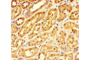 Immunohistochemistry of paraffin-embedded human kidney tissue using ABIN7142008 at dilution of 1:100 (PDK4 antibody  (AA 143-333))