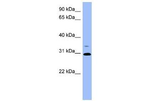 WB Suggested Anti-PSPH Antibody Titration: 0. (PSPH antibody  (Middle Region))