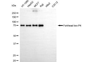 Western blotting analysis using forkhead box P4 antibody (ABIN7798653).
