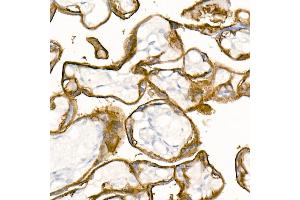 Immunohistochemistry of paraffin-embedded Human placenta using TROP-2 antibody (ABIN7271103) at dilution of 1:2700 (40x lens). (TACSTD2 antibody)