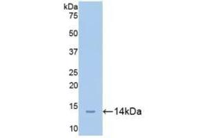 Detection of Recombinant CEACAM1, Mouse using Polyclonal Antibody to Carcinoembryonic Antigen Related Cell Adhesion Molecule 1 (CEACAM1) (CEACAM1 antibody  (AA 35-143))