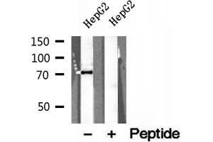Western blot analysis of extracts of HepG2 cells, using ERp72 antibody. (PDIA4 antibody  (Internal Region))