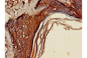 Immunohistochemistry of paraffin-embedded human skin tissue using ABIN7158704 at dilution of 1:100 (JMJD2D antibody  (AA 337-499))