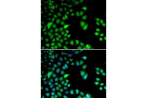 Immunofluorescence (IF) image for anti-Ribosomal Protein S6 Kinase, 90kDa, Polypeptide 3 (RPS6KA3) antibody (ABIN1876624)