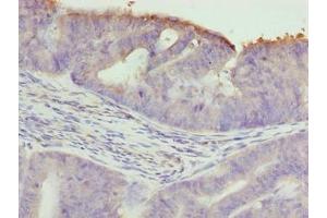 anti-Tetratricopeptide Repeat Domain 30A (TTC30A) (AA 201-500) antibody