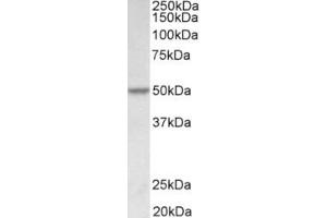 Western Blotting (WB) image for anti-Programmed Cell Death 4 (PDCD4) (Internal Region) antibody (ABIN2465121) (PDCD4 antibody  (Internal Region))