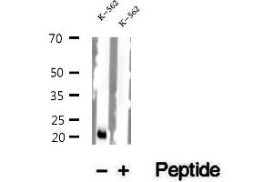 Western blot analysis of extracts of K-562 cells, using NDUFS7 antibody. (NDUFS7 antibody  (Internal Region))