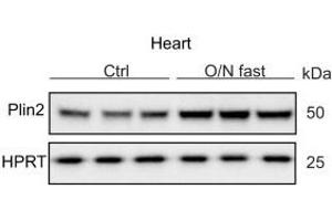 Regulation of Plin2: Immunoblot analysis of Plin2 (ABIN285650) using protein lysates from control (refed) and O/N fasted C57Bl/6N mice hearts (n = 3). (ADRP antibody  (N-Term))