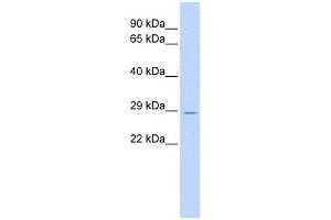TRIM55 antibody used at 1 ug/ml to detect target protein.