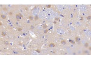 Detection of GKRP in Rat Cerebrum Tissue using Polyclonal Antibody to Glucokinase Regulatory Protein (GKRP) (GCKR antibody  (AA 90-286))