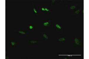 Immunofluorescence of purified MaxPab antibody to TCEB3 on HeLa cell. (TCEB3 antibody  (AA 1-772))