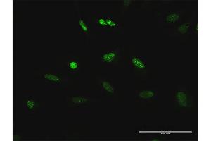 Immunofluorescence (IF) image for anti-Transcription Elongation Factor B (SIII), Polypeptide 3 (110kDa, Elongin A) (TCEB3) (AA 1-772) antibody (ABIN520751)