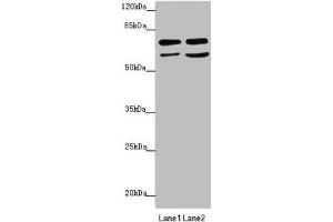 Western blot All lanes: VPS33B antibody at 2. (VPS33B antibody  (AA 348-617))