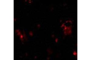 Immunofluorescence of DcR1 in rat liver tissue with AP30279PU-N DcR1 antibody at 10 μg/ml. (DcR1 antibody)