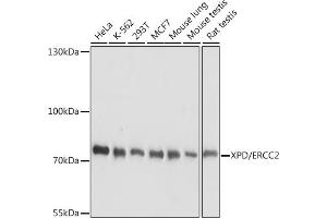Western blot analysis of extracts of various cell lines, using XPD/ERCC2 antibody (ABIN7267056) at 1:1000 dilution. (ERCC2 antibody  (AA 1-180))