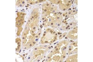 Immunohistochemistry of paraffin-embedded human kidney using PHF21B antibody. (PHF21B antibody  (AA 322-531))