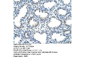Human Lung (Pirin antibody  (C-Term))