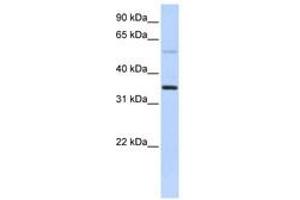 Image no. 1 for anti-Ankyrin Repeat Domain 9 (ANKRD9) (AA 144-193) antibody (ABIN6741189) (ANKRD9 antibody  (AA 144-193))