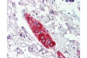 IHC testing of FFPE human colon tissue with FEZ1 antibody at 5ug/ml. (FEZ1 antibody)