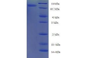 Neurexophilin and PC-Esterase Domain Family, Member 3 (NXPE3) (AA 31-559) protein (His-SUMO Tag)