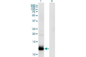 Western Blot analysis of WFDC5 expression in transfected 293T cell line by WFDC5 monoclonal antibody (M03), clone 5G5. (WFDC5 antibody  (AA 25-123))