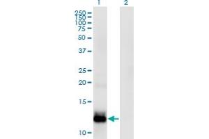 WFDC5 antibody  (AA 25-123)