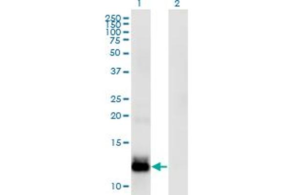 WFDC5 抗体  (AA 25-123)