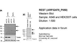 Western Blotting (WB) image for anti-RE1-Silencing Transcription Factor (REST) (Middle Region) antibody (ABIN2779670) (REST antibody  (Middle Region))