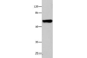 Western blot analysis of 293T cell, using CNGA2 Polyclonal Antibody at dilution of 1:500 (CNGA2 antibody)