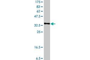 Western Blot detection against Immunogen (37 KDa) . (NPR3 antibody  (AA 42-140))