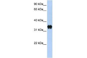 PYCR2 antibody used at 1 ug/ml to detect target protein. (PYCR2 antibody  (C-Term))